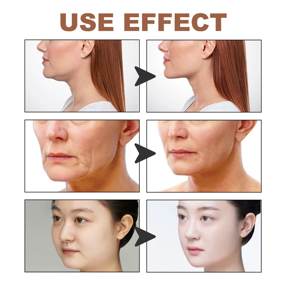 Face Lift Band Face Anti-Sagging Lift Remove Eye Wrinkles V-Shaped Face Breathable Lifting Face Paste Reusable Face Lift Tape