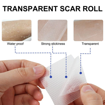 1 Roll Invisible Silicone Scar Sheets Self-Adhesive Scar Cover Tape Reusable and Effective Skin Care Strips