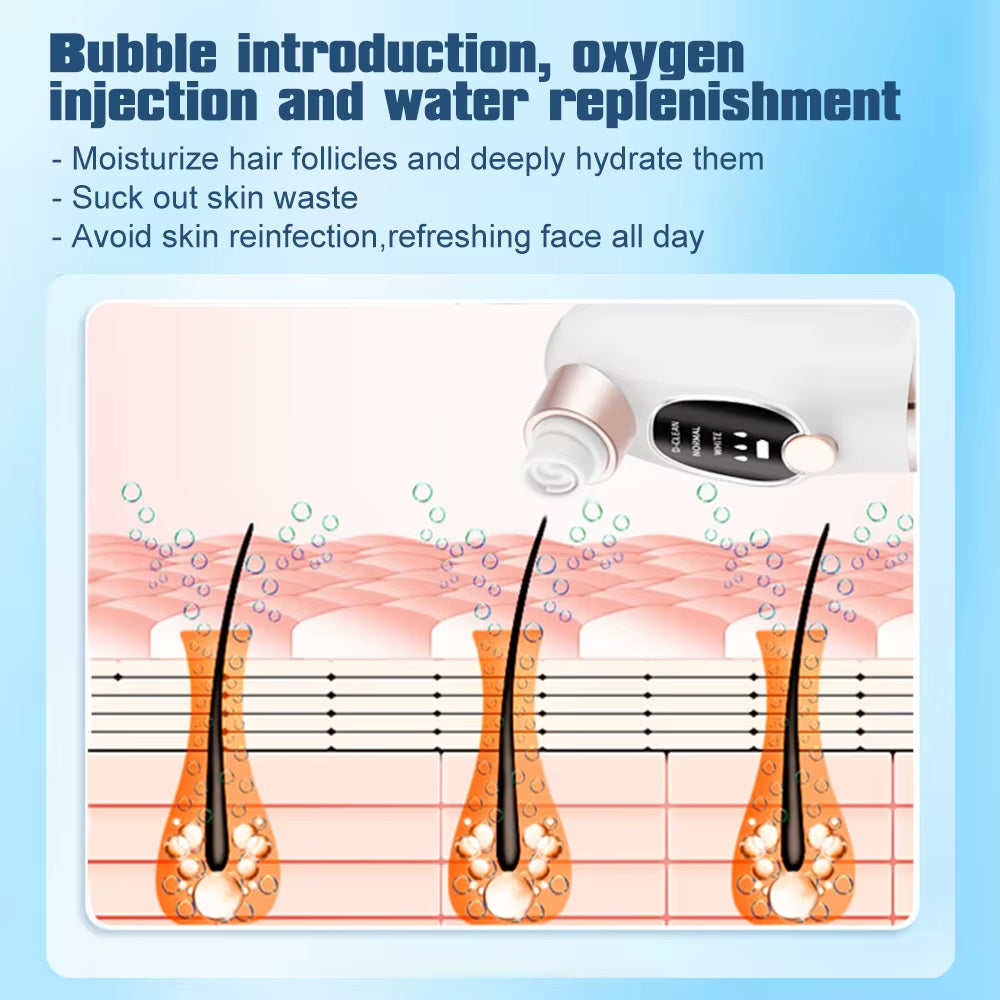 Electric Blackhead Remover Pore Vacuum Cleaner Facial Black Dots Vacuum Cleaner Acne Pimple Blackhead Removal Black Dots Remover