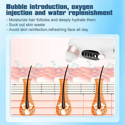 Electric Blackhead Remover Pore Vacuum Cleaner Facial Black Dots Vacuum Cleaner Acne Pimple Blackhead Removal Black Dots Remover