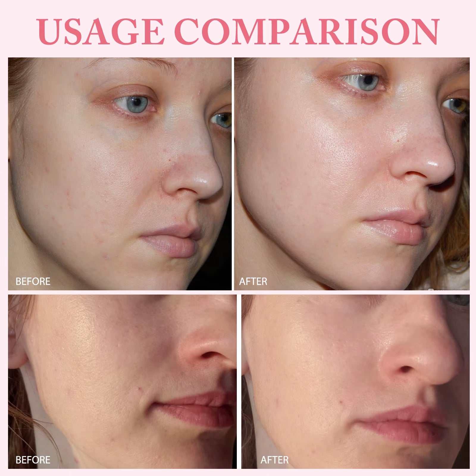 10Pcs/Box PDRN Serum Moisturizing Repairs Brightens Reduces Sagging Skin Care Essence Benefits anti Aging Facial Treatment