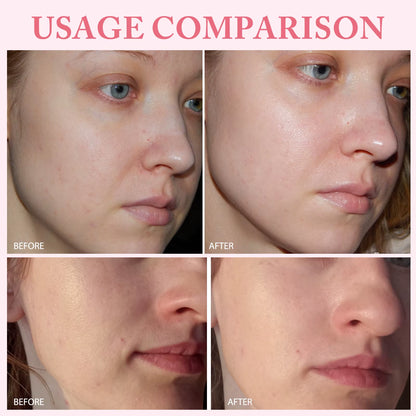 10Pcs/Box PDRN Serum Moisturizing Repairs Brightens Reduces Sagging Skin Care Essence Benefits anti Aging Facial Treatment