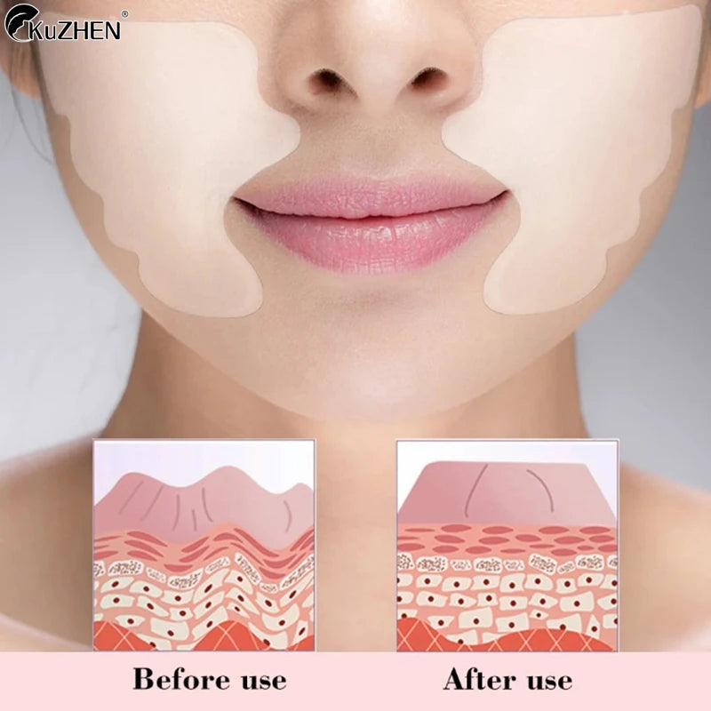 Facial Wrinkle Remover Pad Reusable Medical Grade Silicone Nasolabial Folds Anti-Aging Mask Prevent Wrinkle Skin Lifting Patches