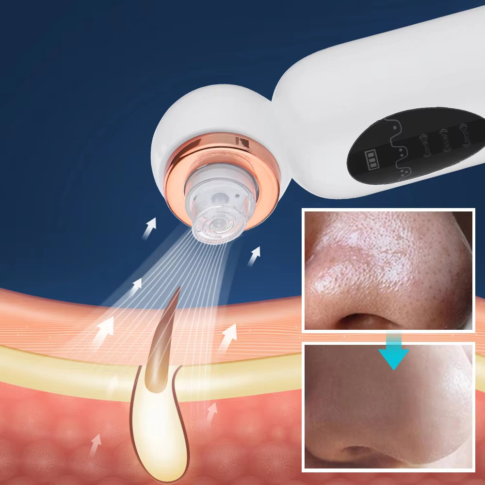 Small Bubble Home Use Handheld Skin Care Vacuum Pore Cleaner for Face Strong Suction Power Blackheads Removal Machine
