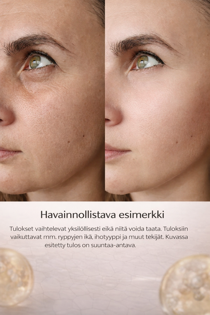 Kasvoseerumi – luonnollinen retinoli-vaihtoehto juonteille & ihon kirkastukseen Bakuchiol 60 ml– dermveda