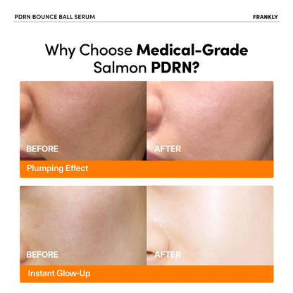 PDRN Bounce Ball Serum