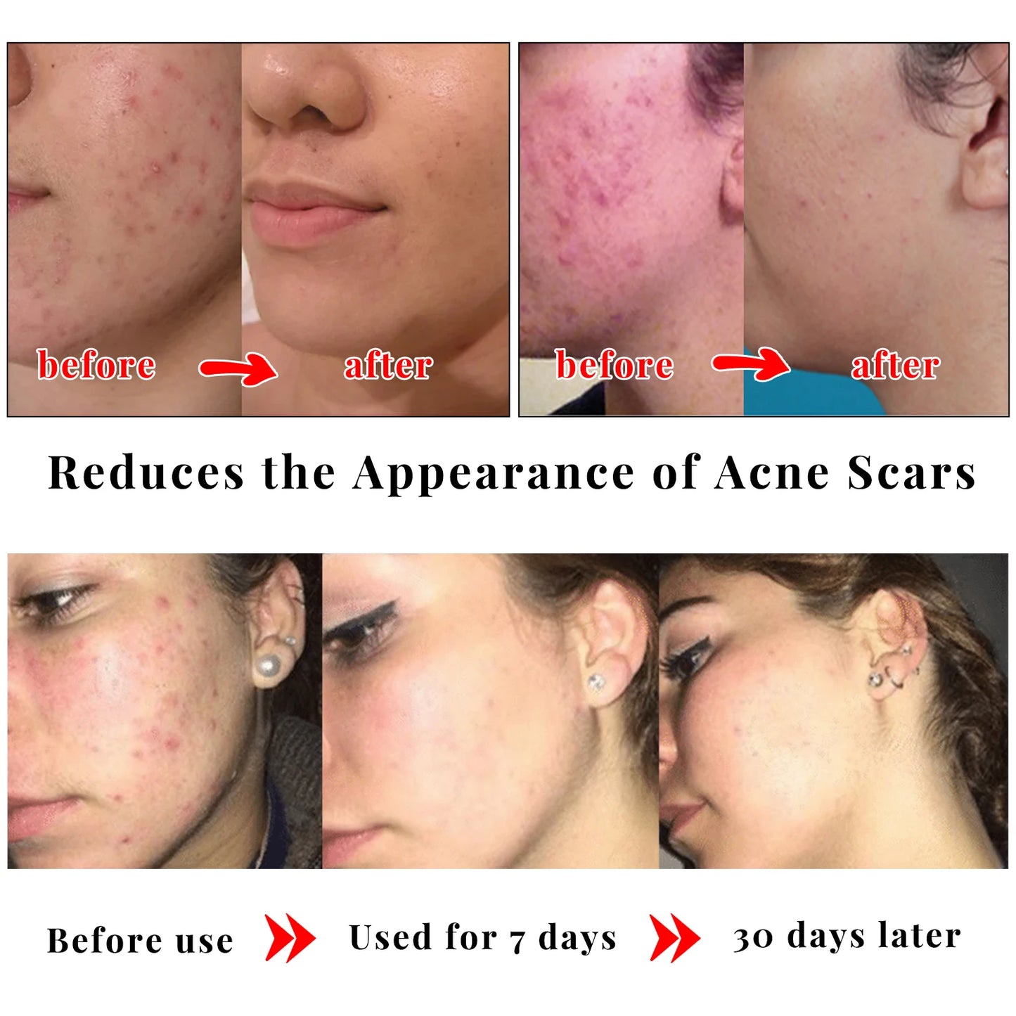 Kojic Acid Glow Soap Facial Deep Cleaning Even Skin Tone Skin Lightening Soap Oil Control Moisturizing Skin Care 65G X2