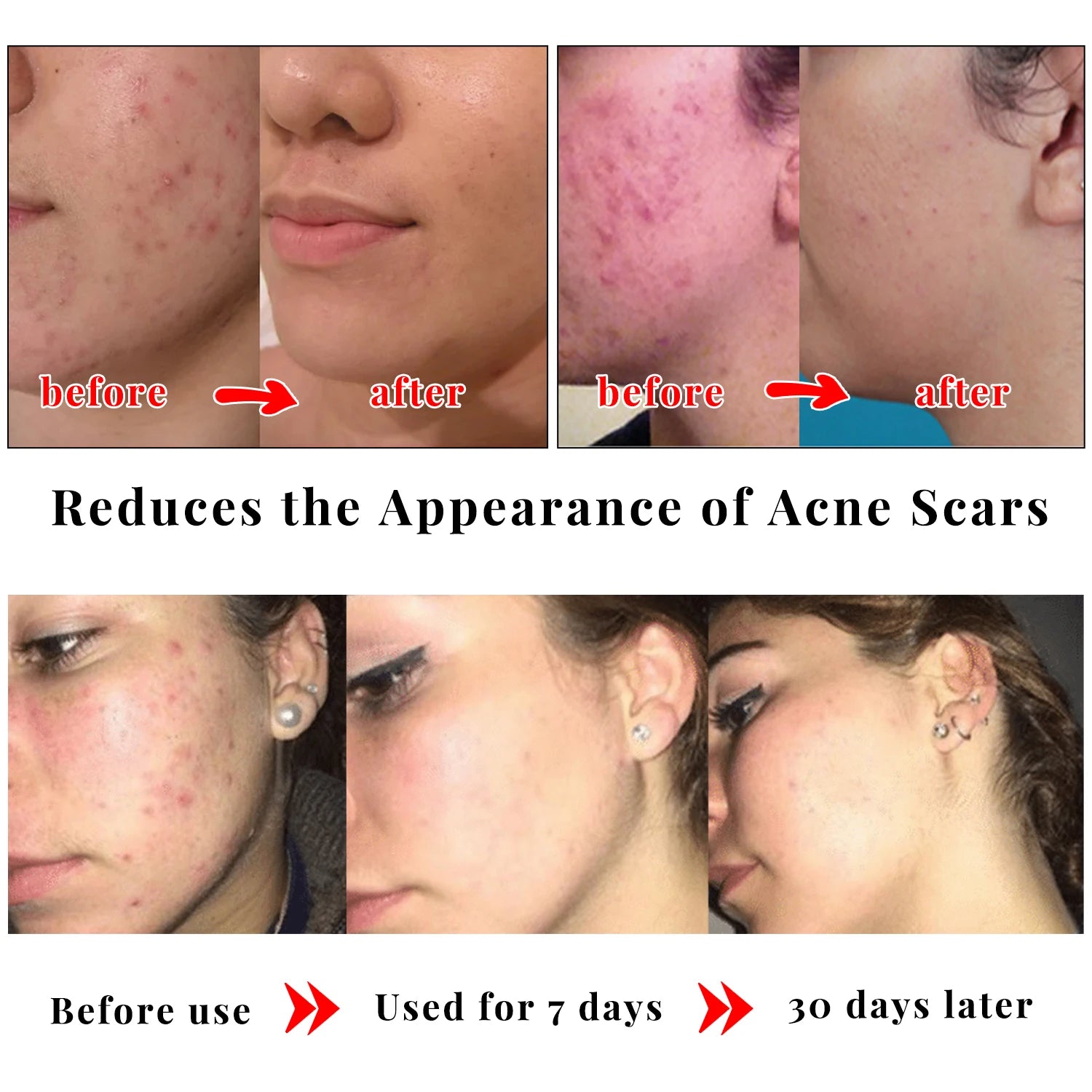 Kojic Acid Glow Soap Facial Deep Cleaning Even Skin Tone Skin Lightening Soap Oil Control Moisturizing Skin Care 65G X2